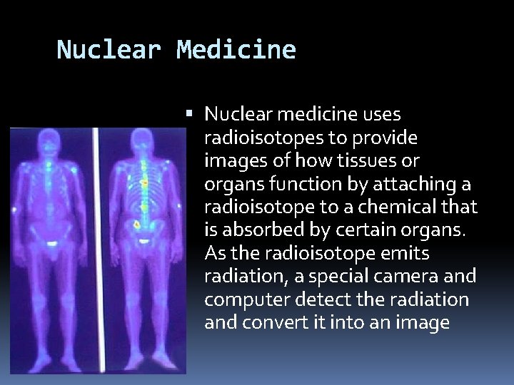 Nuclear Medicine Nuclear medicine uses radioisotopes to provide images of how tissues or organs