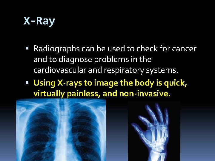 X-Ray Radiographs can be used to check for cancer and to diagnose problems in