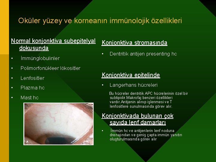 Oküler yüzey ve korneanın immünolojik özellikleri Normal konjonktiva subepitelyal dokusunda • İmmünglobulinler • Polimorfonükleer