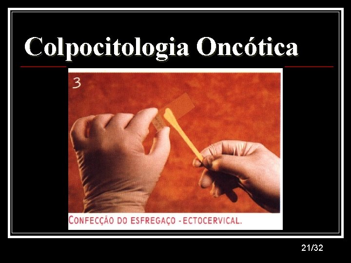 Colpocitologia Oncótica 21/32 