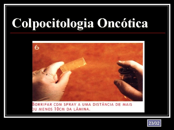 Colpocitologia Oncótica 23/32 