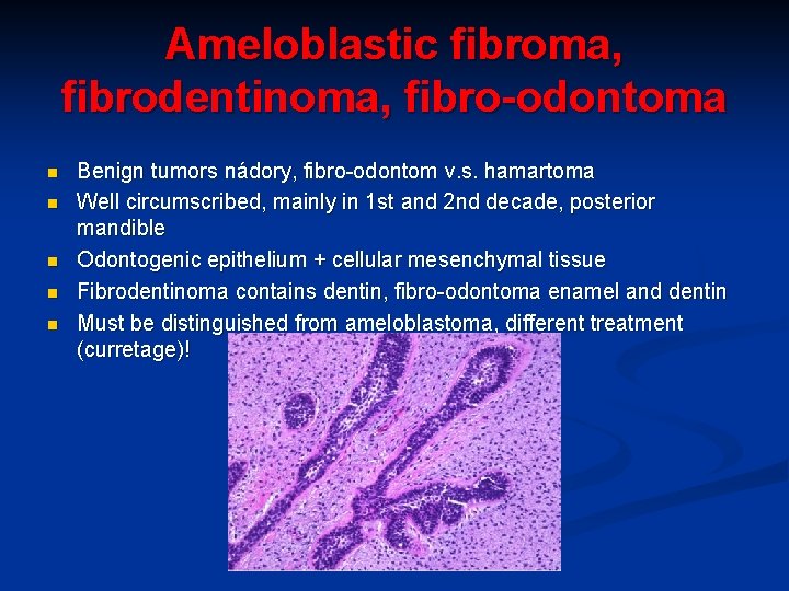 Ameloblastic fibroma, fibrodentinoma, fibro-odontoma n n n Benign tumors nádory, fibro-odontom v. s. hamartoma