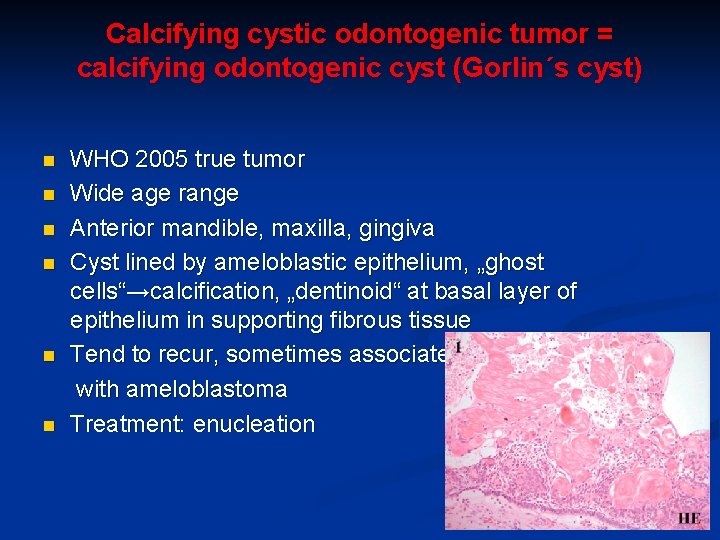 Calcifying cystic odontogenic tumor = calcifying odontogenic cyst (Gorlin´s cyst) n n n WHO