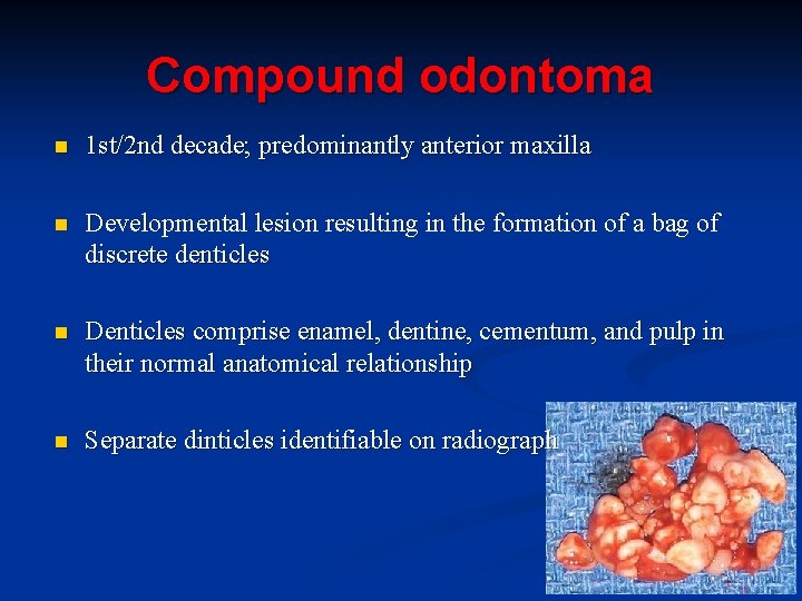 Compound odontoma n 1 st/2 nd decade; predominantly anterior maxilla n Developmental lesion resulting