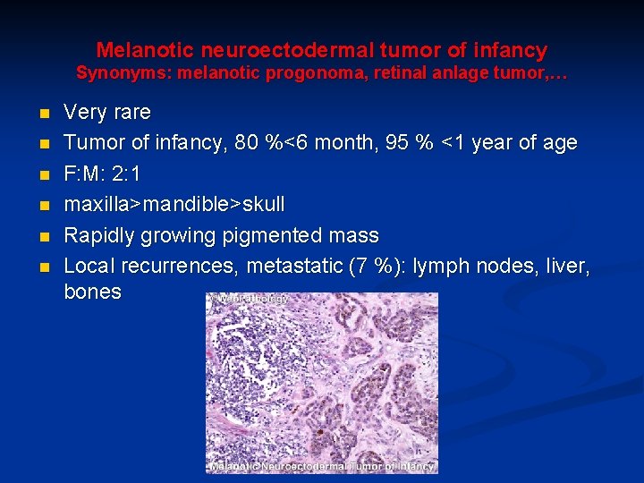 Melanotic neuroectodermal tumor of infancy Synonyms: melanotic progonoma, retinal anlage tumor, … n n