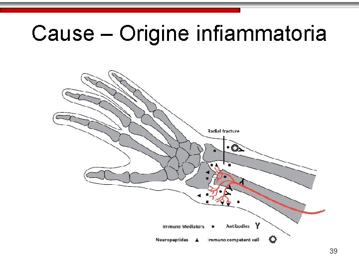 Cause – Origine infiammatoria 39 