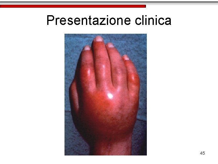 Presentazione clinica 45 