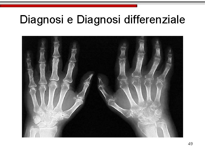 Diagnosi e Diagnosi differenziale 49 