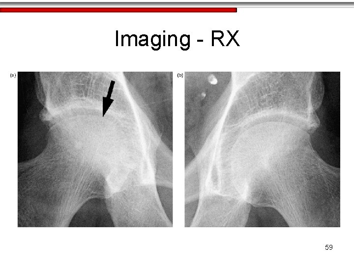 Imaging - RX 59 