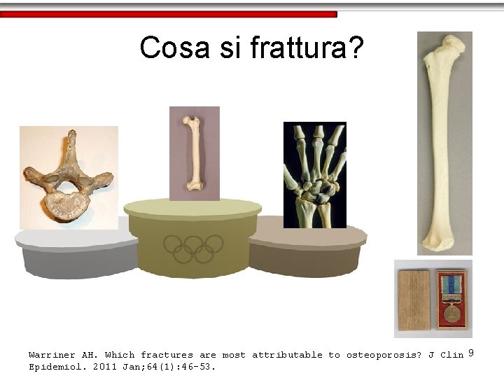 Cosa si frattura? Warriner AH. Which fractures are most attributable to osteoporosis? J Clin