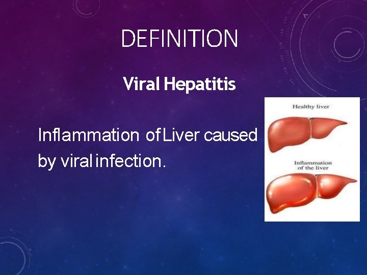 DEFINITION Viral Hepatitis Inflammation of Liver caused by viral infection. 