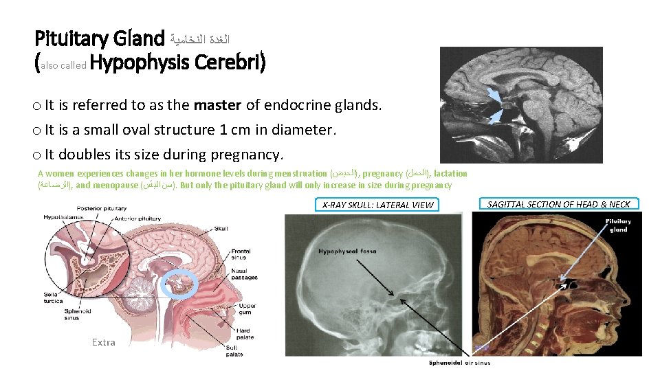 Pituitary Gland ﺍﻟﻐﺪﺓ ﺍﻟﻨﺨﺎﻣﻴﺔ (also called Hypophysis Cerebri) o It is referred to as