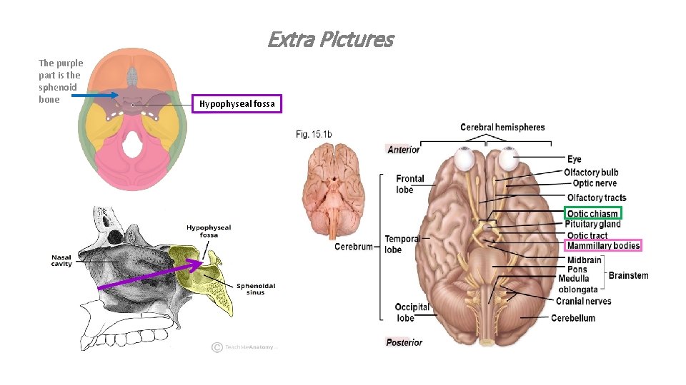 Extra Pictures The purple part is the sphenoid bone Hypophyseal fossa 