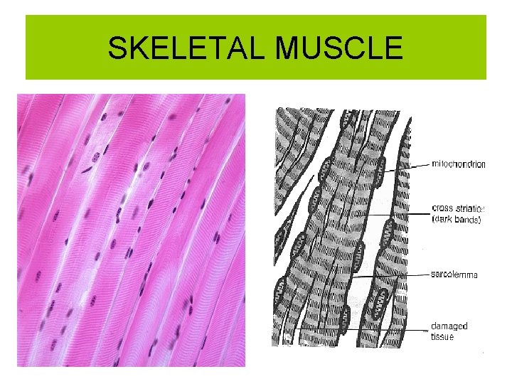 SKELETAL MUSCLE 