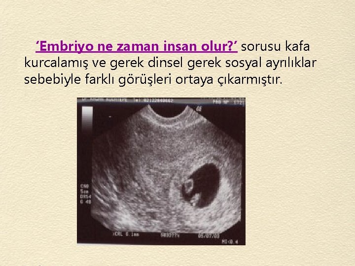 ‘Embriyo ne zaman insan olur? ’ sorusu kafa kurcalamış ve gerek dinsel gerek sosyal
