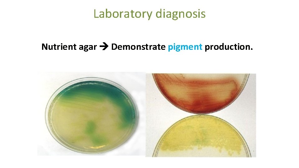 Laboratory diagnosis Nutrient agar Demonstrate pigment production. 