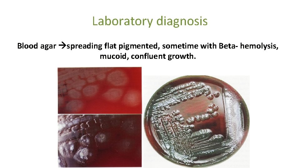 Laboratory diagnosis Blood agar spreading flat pigmented, sometime with Beta- hemolysis, mucoid, confluent growth.