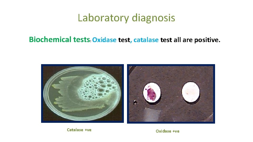 Laboratory diagnosis Biochemical tests: Oxidase test, catalase test all are positive. Catalase +ve Oxidase