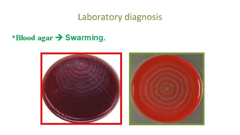 Laboratory diagnosis *Blood agar Swarming. 