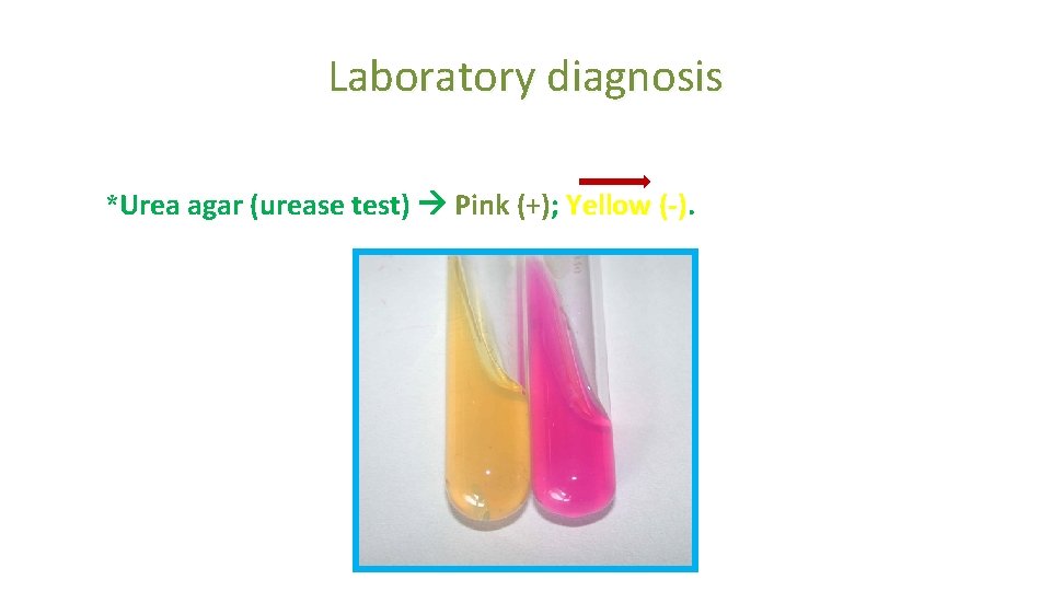 Laboratory diagnosis *Urea agar (urease test) Pink (+); Yellow (-) 