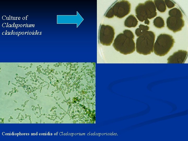 Culture of Cladsporium cladosporioides Conidiophores and conidia of Cladosporium cladosporioides. 