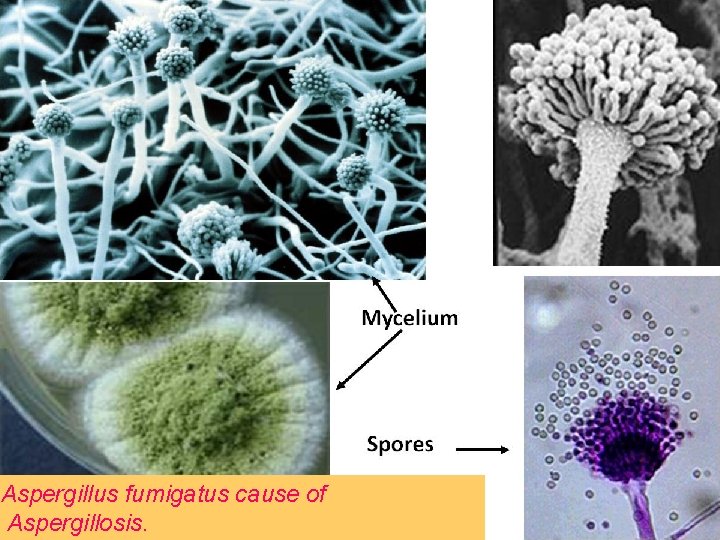 Aspergillus fumigatus cause of Aspergillosis. 