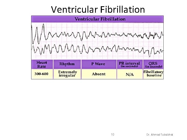 Ventricular Fibrillation 10 Dr. Ahmad Tubaishat 