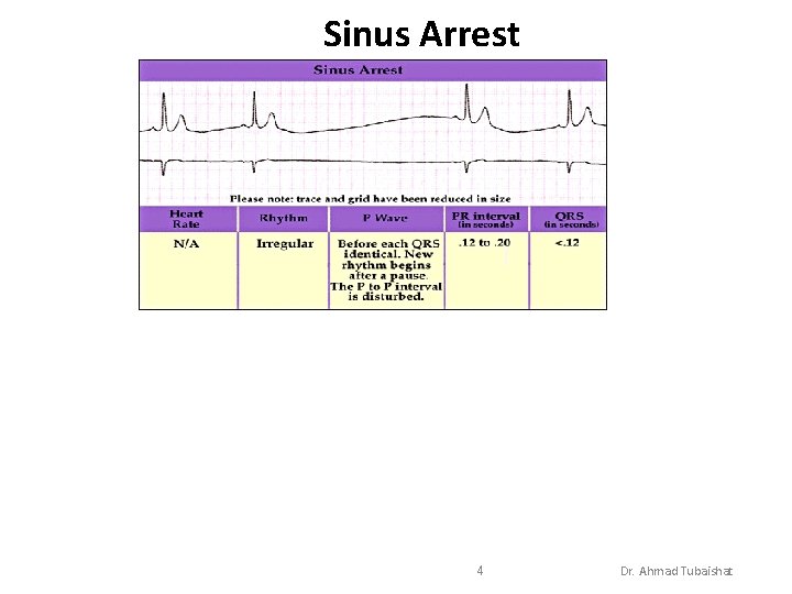 Sinus Arrest 4 Dr. Ahmad Tubaishat 