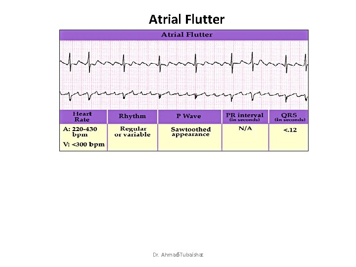 Atrial Flutter Dr. Ahmad 5 Tubaishat 