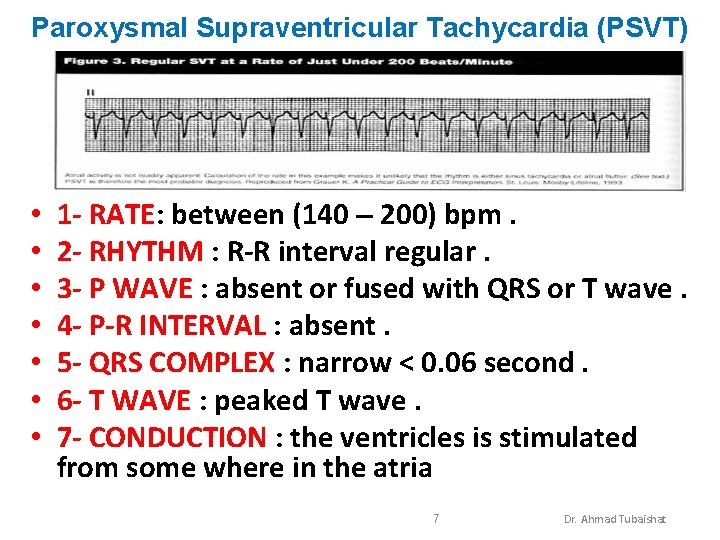 Paroxysmal Supraventricular Tachycardia (PSVT) • • 1 - RATE: between (140 – 200) bpm.