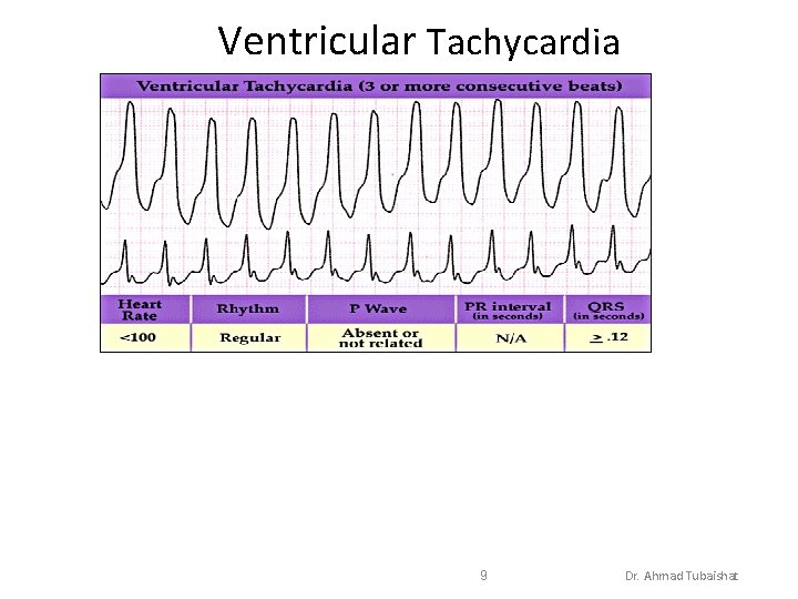 Ventricular Tachycardia 9 Dr. Ahmad Tubaishat 