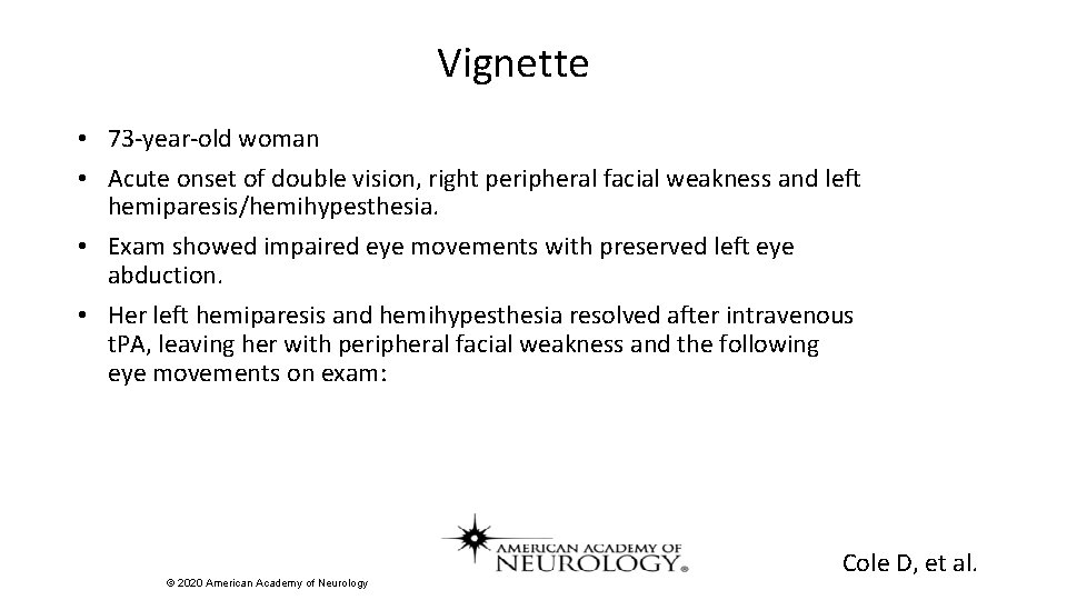 Vignette • 73 -year-old woman • Acute onset of double vision, right peripheral facial