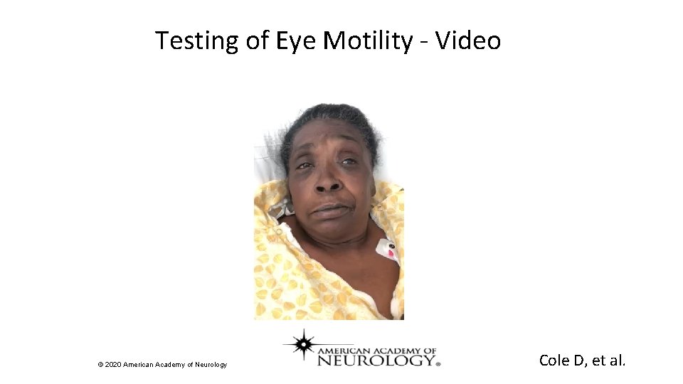 Testing of Eye Motility - Video © 2020 American Academy of Neurology Cole D,