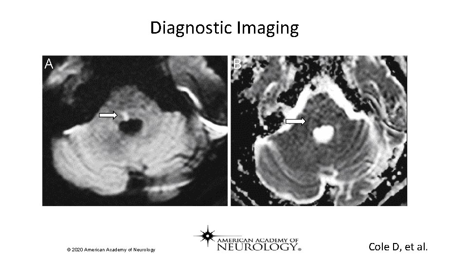Diagnostic Imaging © 2020 American Academy of Neurology Cole D, et al. 