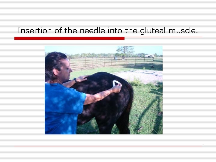 Insertion of the needle into the gluteal muscle. 