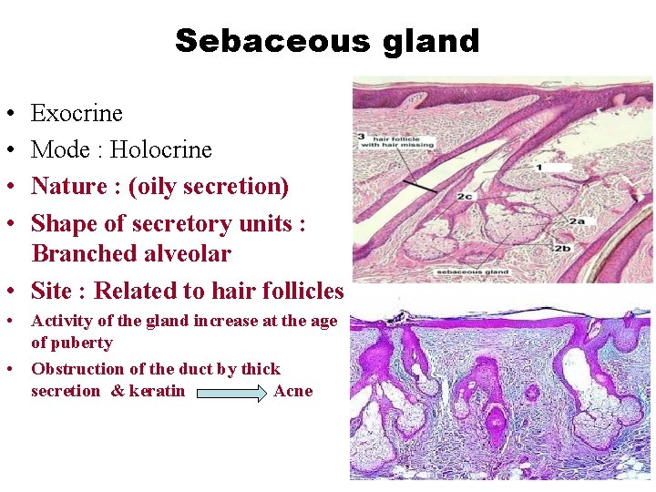 Sebaceous gland • • Exocrine Mode : Holocrine Nature : (oily secretion) Shape of