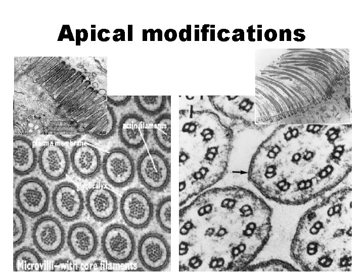 Apical modifications 