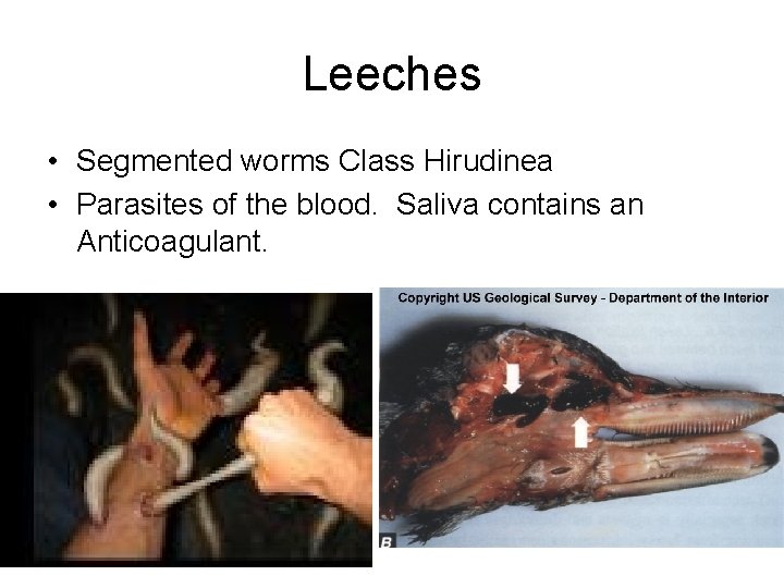 Leeches • Segmented worms Class Hirudinea • Parasites of the blood. Saliva contains an