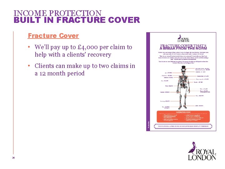 INCOME PROTECTION BUILT IN FRACTURE COVER Fracture Cover • We’ll pay up to £