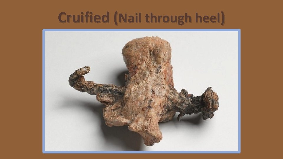 Cruified (Nail through heel) 
