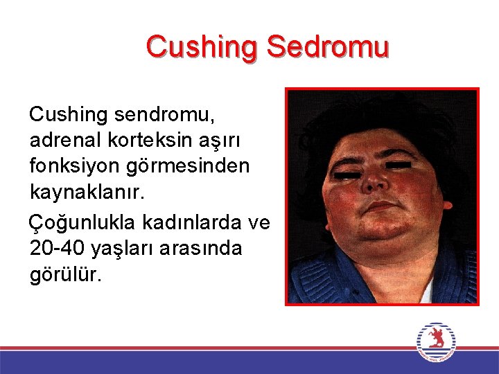 Cushing Sedromu Cushing sendromu, adrenal korteksin aşırı fonksiyon görmesinden kaynaklanır. Çoğunlukla kadınlarda ve 20