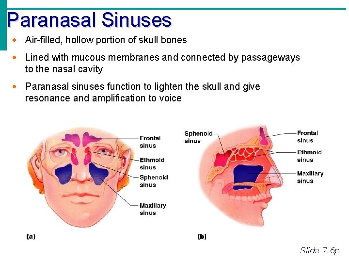 Paranasal Sinuses · Air-filled, hollow portion of skull bones · Lined with mucous membranes