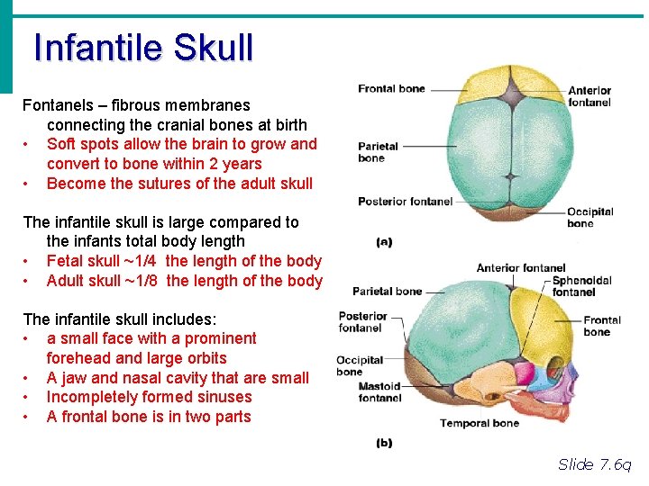 Infantile Skull Fontanels – fibrous membranes connecting the cranial bones at birth • Soft