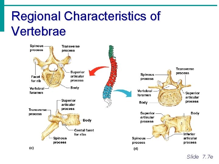 Regional Characteristics of Vertebrae Slide 7. 7 e 