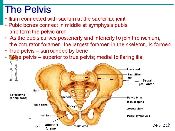 The Pelvis • Ilium connected with sacrum at the sacroiliac joint • Pubic bones