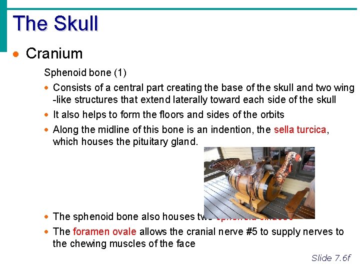 The Skull · Cranium Sphenoid bone (1) · Consists of a central part creating