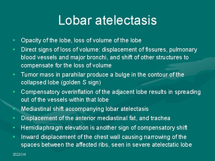 Lobar atelectasis • Opacity of the lobe, loss of volume of the lobe •