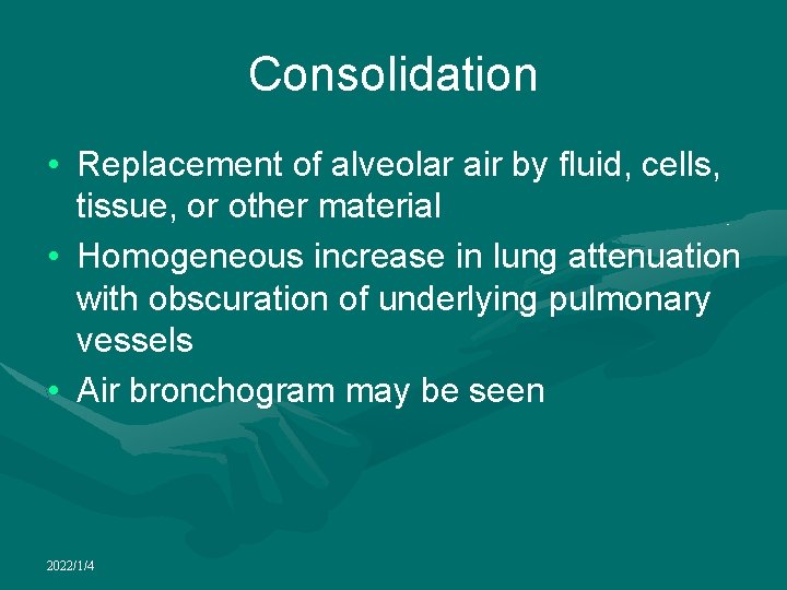 Consolidation • Replacement of alveolar air by fluid, cells, tissue, or other material •