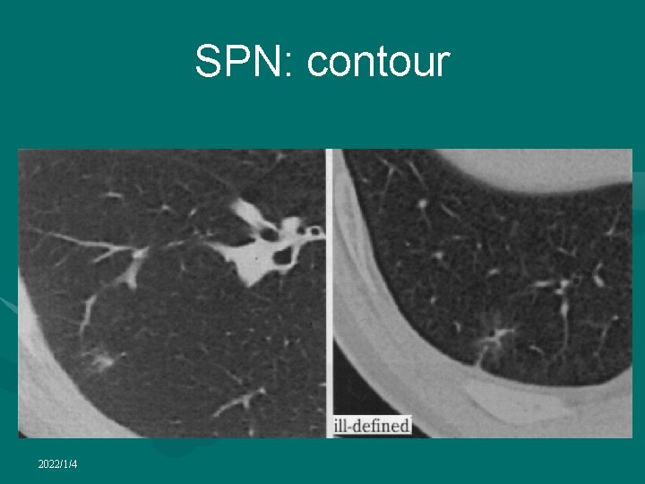 SPN: contour 2022/1/4 