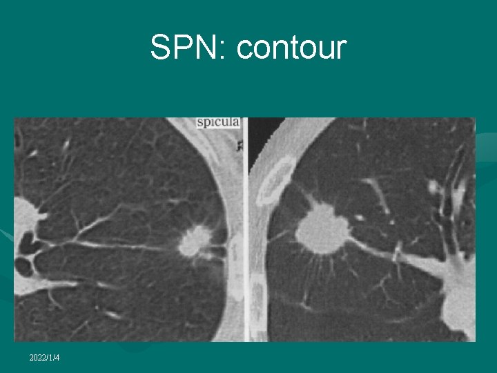 SPN: contour 2022/1/4 